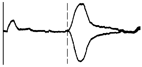電纜終端開路與短路脈沖反射波形比較 電纜終端開路與短路脈沖反射波形比較